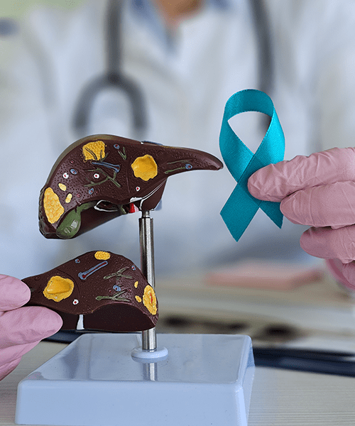 los sintomas del cancer de pancreas