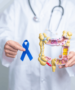 la relacion de la alimentación con el cancer de colon