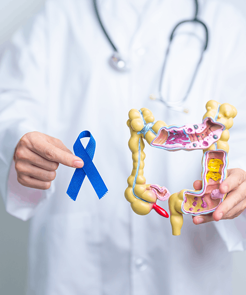 la relacion de la alimentación con el cancer de colon